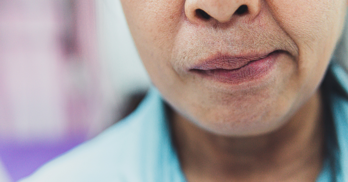 Progressive Supranuclear Palsy Cause: Factors Behind This Condition