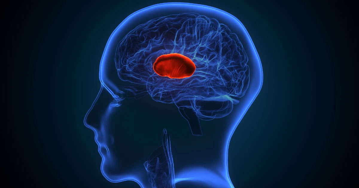3D medical illustration showing the brain with highlighted basal ganglia region, representing brain changes linked to Corticobasal Degeneration.
