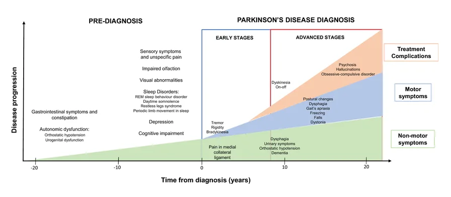 Parkinson's Disease Progression by Movement Disorder Specialist Dr. Mitesh Chandarana
