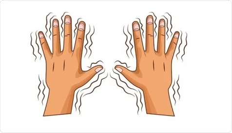 Two hands showing shaking movements caused by essential tremors (ET).