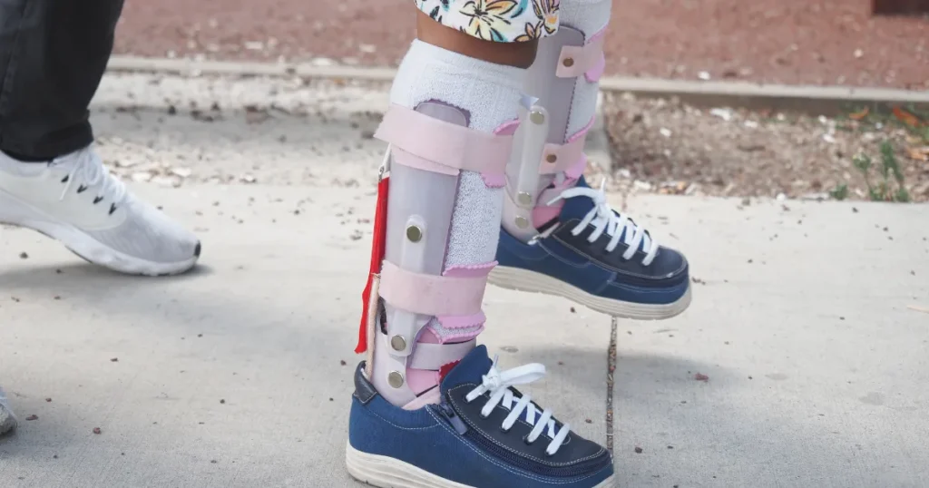 Leg braces worn for balance support in a person with PSP, representing mobility challenges linked to PSP causes.