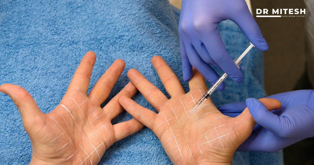 A Botulinum Injection Specialist administering precise injections into the hands to treat movement disorders under sterile conditions.