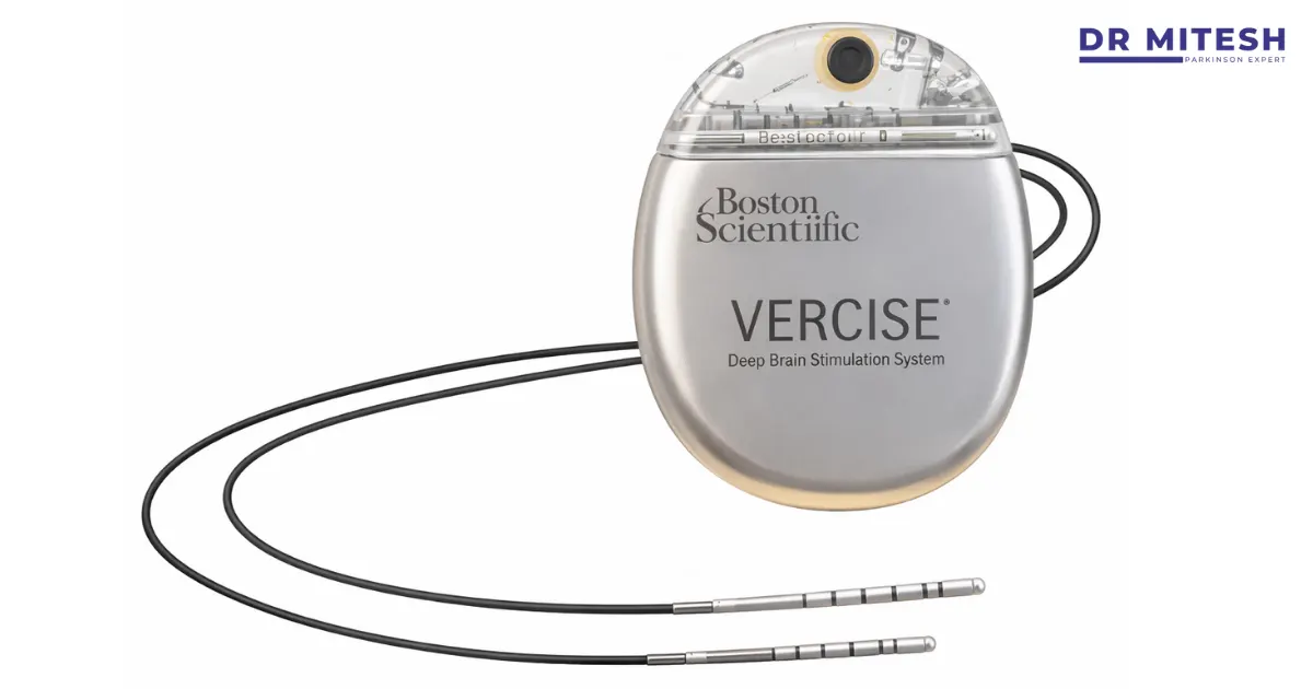 DBS battery device used in deep brain stimulation showing DBS battery life and implanted neurostimulator