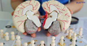 Medical professional holding a brain model to explain the differences between MSA-P and MSA-C.